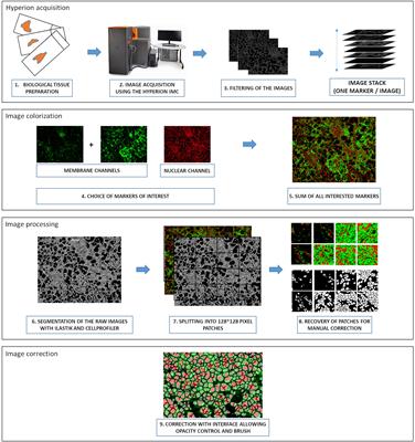 YOUPI: Your powerful and intelligent tool for segmenting cells from imaging mass cytometry data